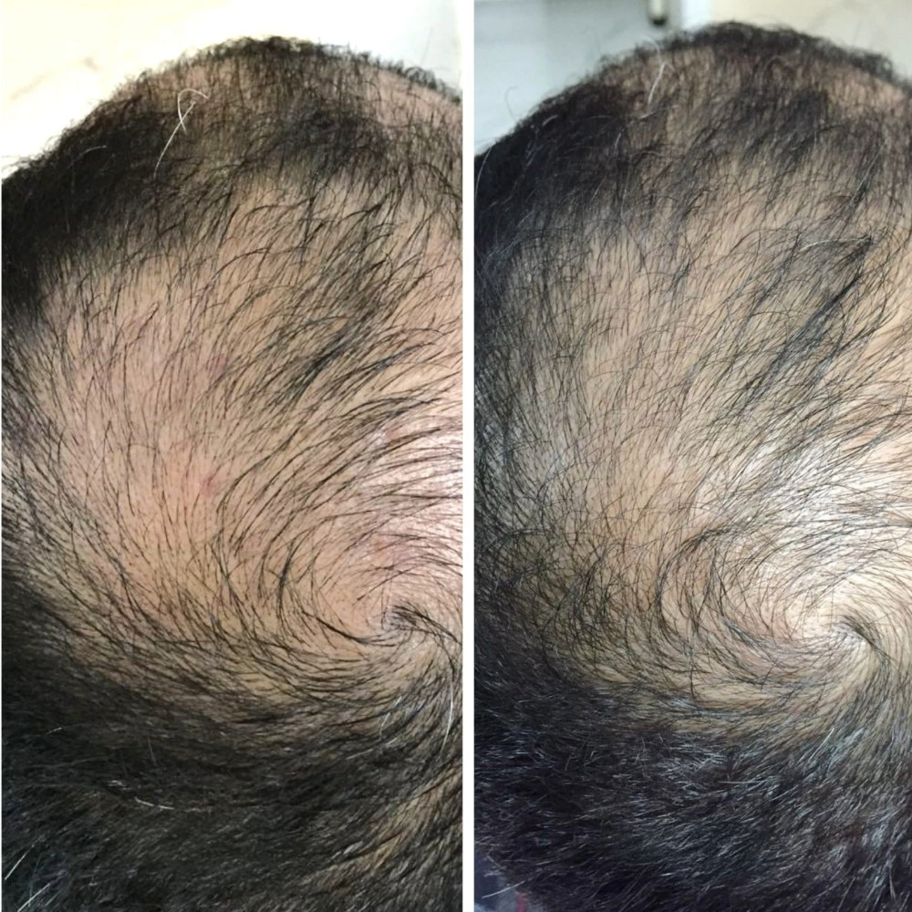 Healthier roots and fuller density
