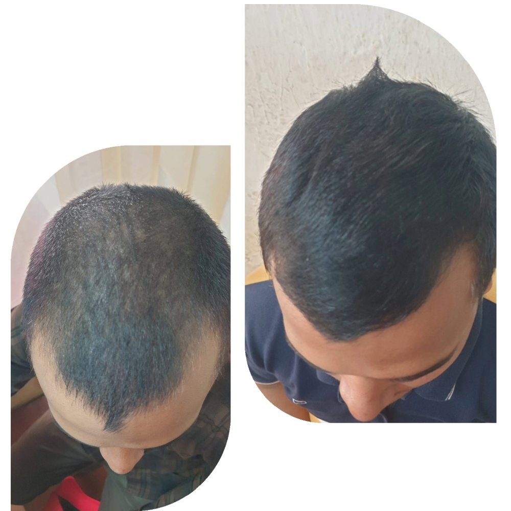 Noticeable baby hair growth